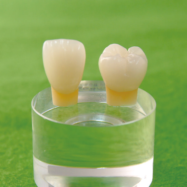 オールセラミック ファインセラミック