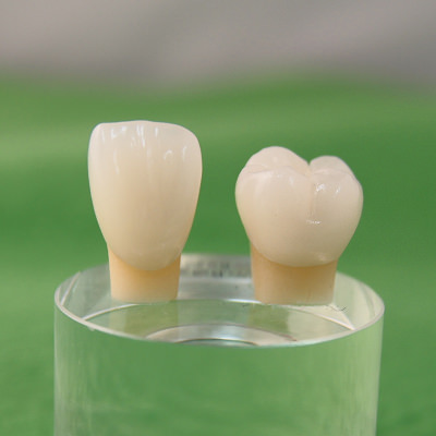 ジルコニアセラミック