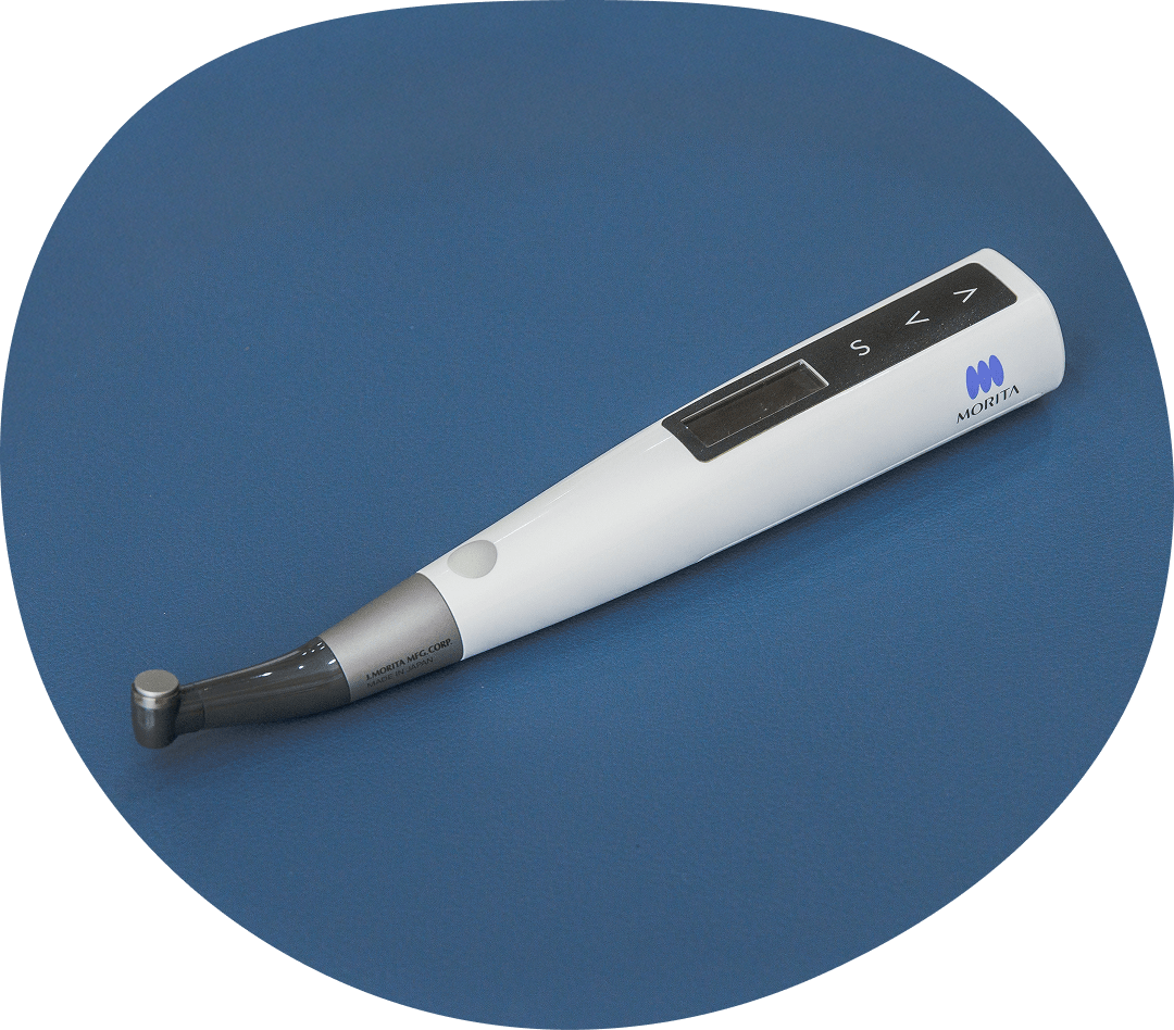 電動根管治療器(トライオート)を利用した精密な根管治療