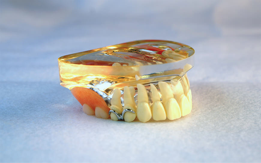 従来のバネのあるタイプ