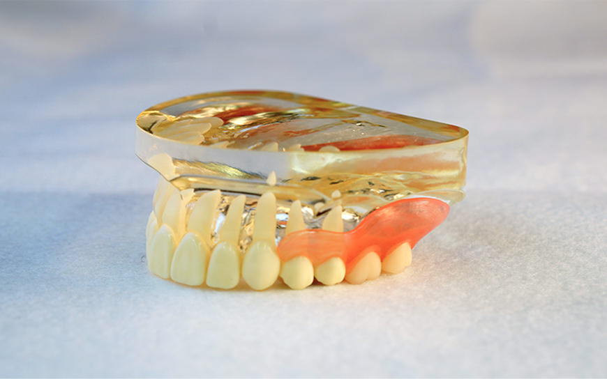 ハッピーデンチャー（バネのないタイプ）