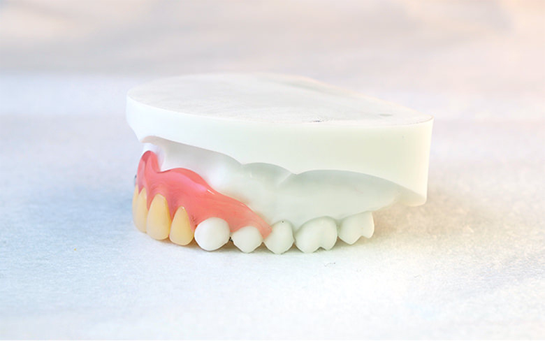 ハッピーデンチャー（ノンクラスプデンチャー）