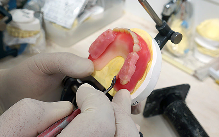 歯科技工士が常駐。細かな調整がスムーズ