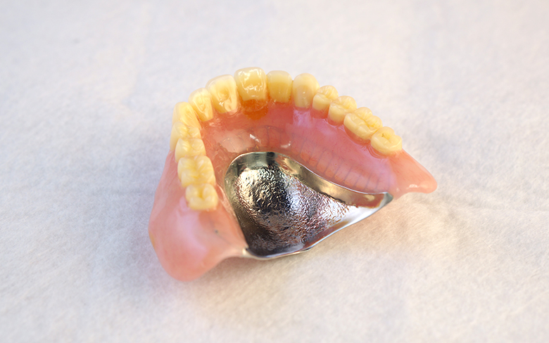 自費の入れ歯