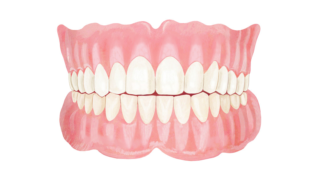 総入れ歯（全部床義歯）