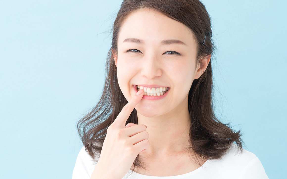 インプラントのメリット