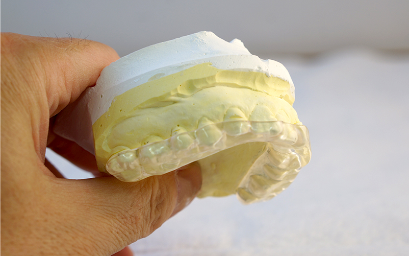 スプリント療法(マウスピース治療)