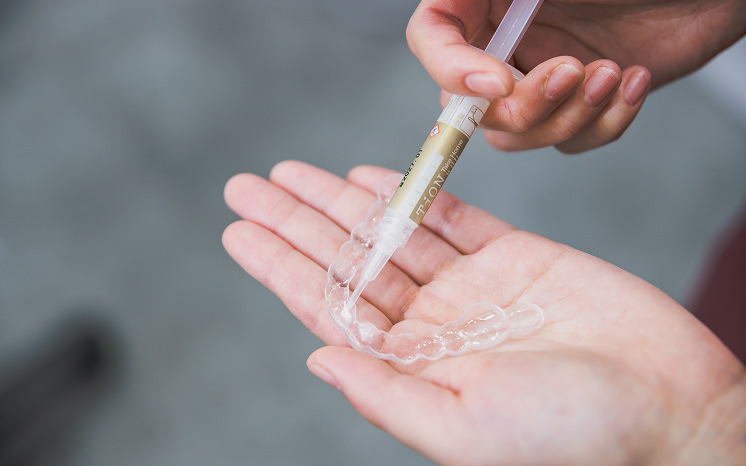 ご自宅でホワイトニング