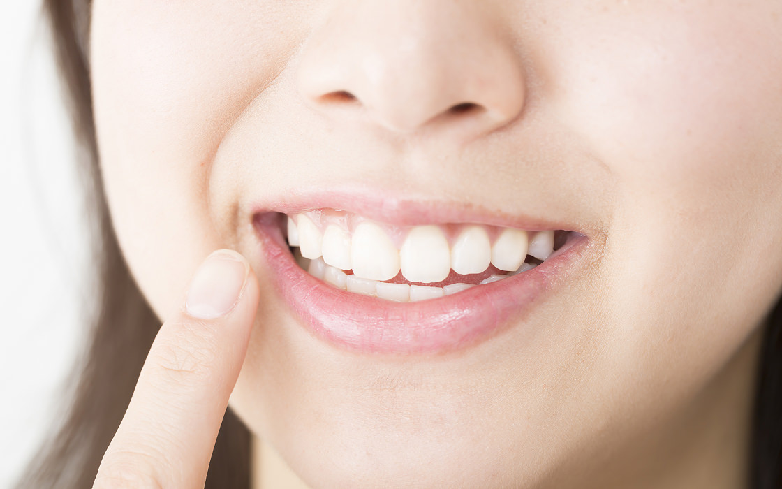 ホワイトニングとは